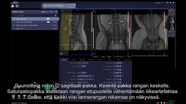 Kkuvakaappaus videosta, jossa kolme magneettikuvaa lannerangasta.