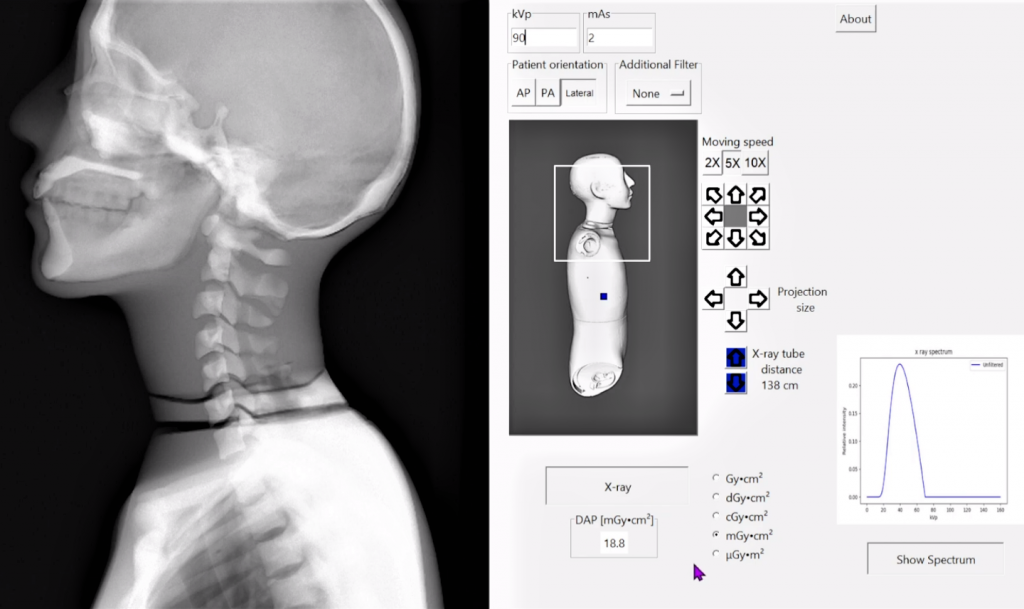 Kuvakaappaus natiiviröntgentutkimussimulaattorin käyttöliittymästä. Siinä näkyy röntgenkuva ja ohjelmassa olevia säätömahdollisuuksia.