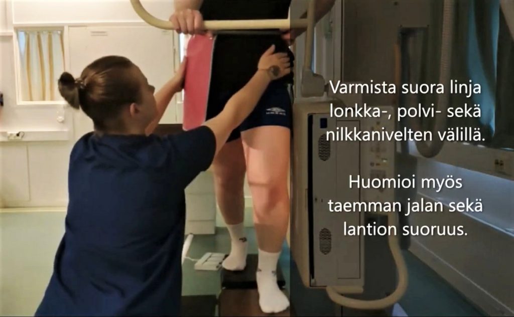 Kuvakaappaus alaraajan natiiviröntgentutkimukseen liittyvästä videomateriaalista.